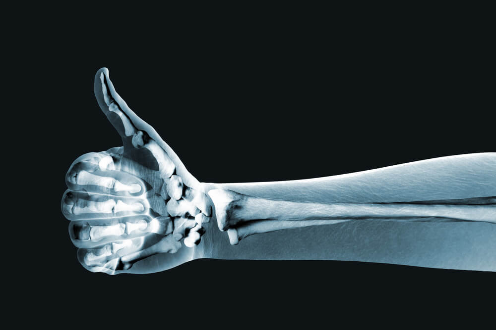 Picture of a an x-ray of a hand with bones visible