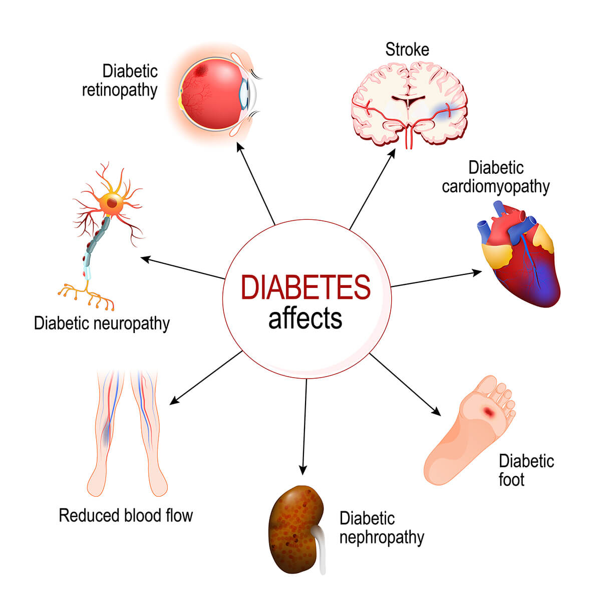 Diabetes affects

