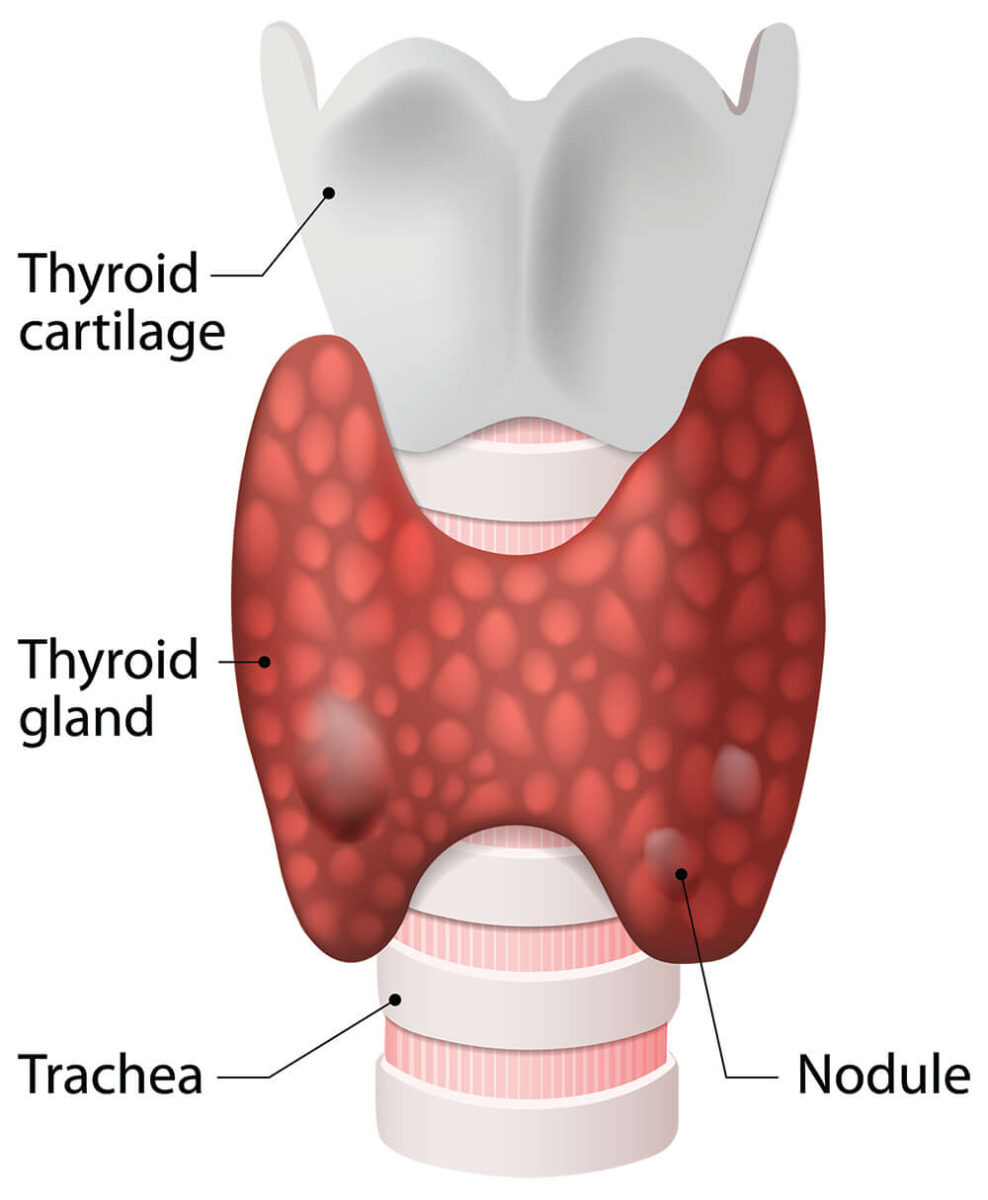 Thyroid